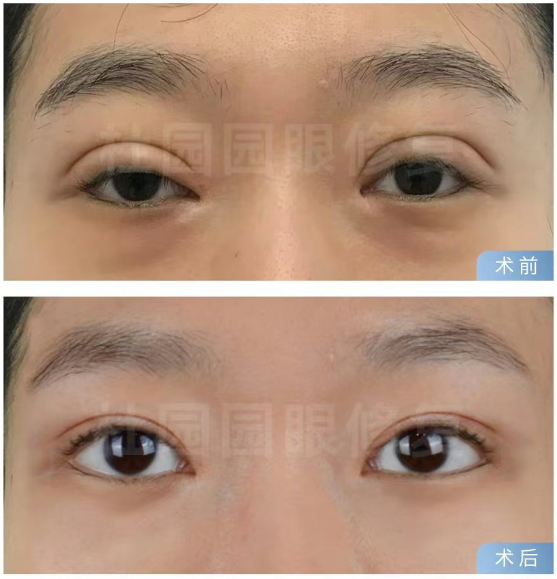 上海眼修复好的医生排名前十有哪些？