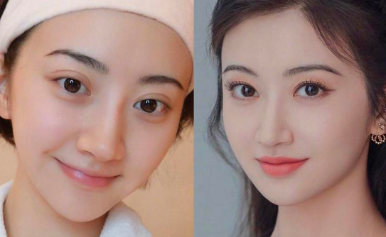 2025年上海九院割双眼皮哪个医生好？