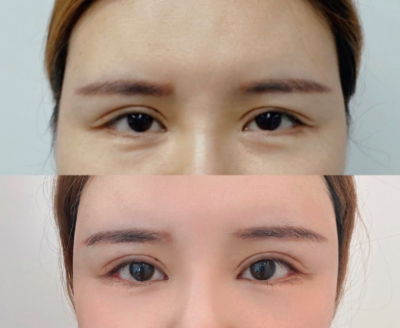深圳眼睛修复比较好的医生有哪些？王志东、朱武根、朱辉？