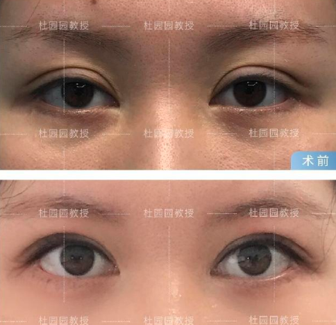 2025年上海知名的眼修复专家有哪些？张楚、李勇、郑小红和杜园园？