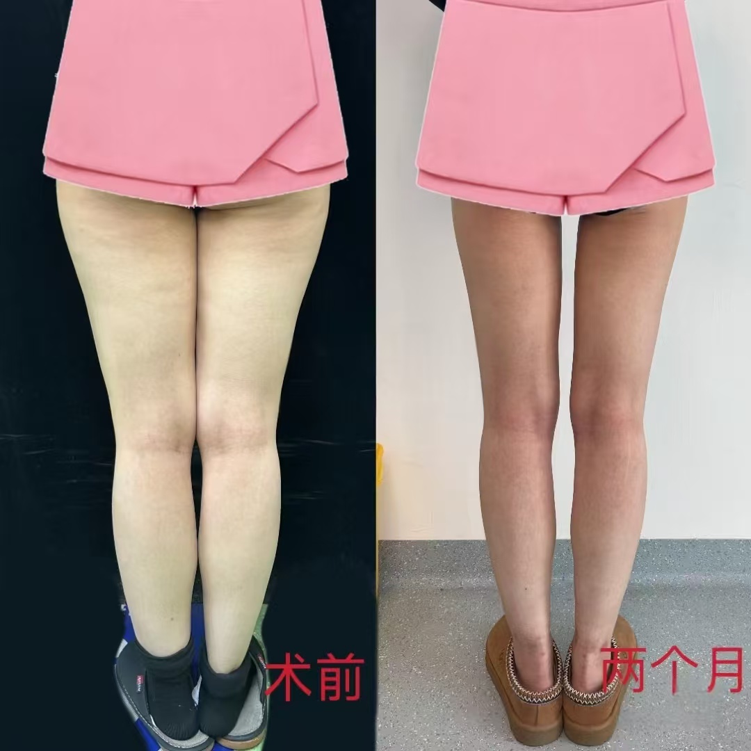 北京八大处吸脂技术最好的医生是哪个？