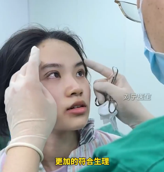刘宁双眼皮