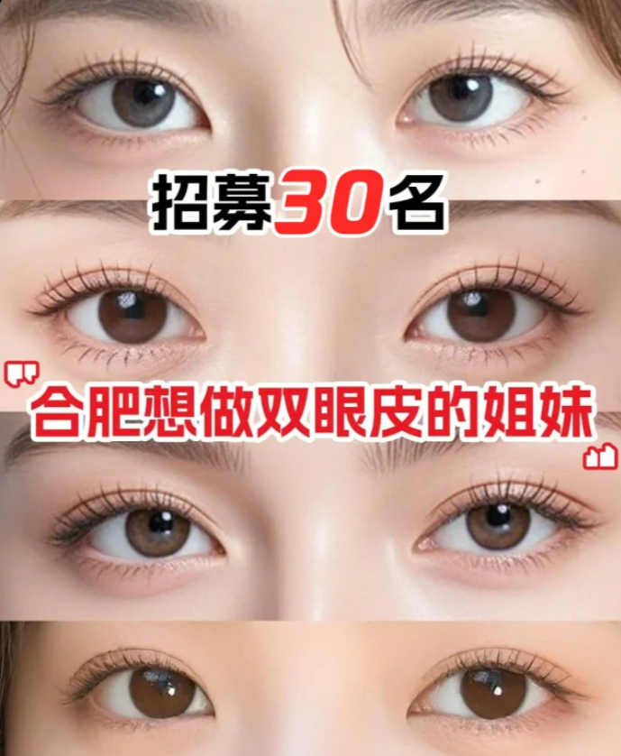 合肥双眼皮医生哪个技术好？口碑也好？