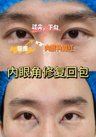 杨晨光