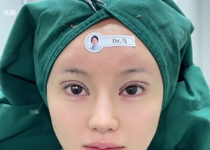 马娟眼修复案例