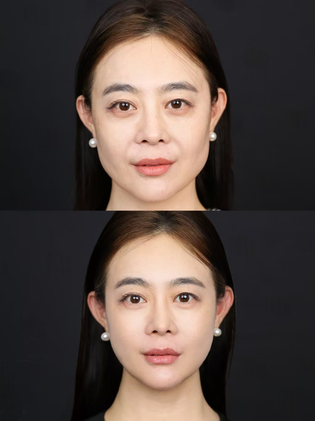 北京知名注射医生有哪些？擅长面部抗衰、皮贴骨、面部轮廓哪个最好？