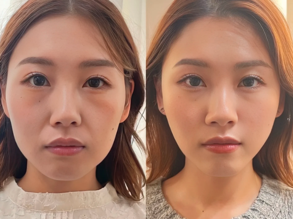 广州馒化修复最好的医生是哪个？齐云香和姬付康哪个好？