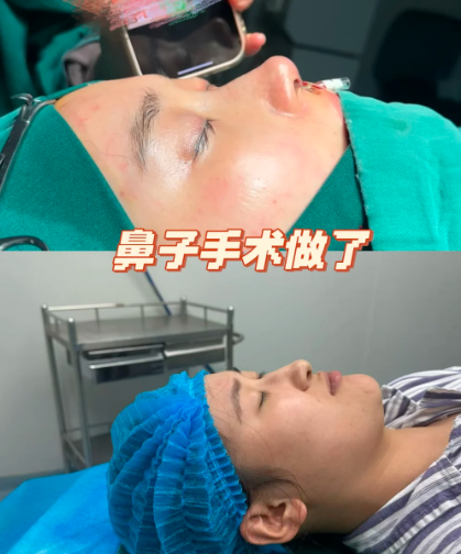 2026济南隆鼻医生哪个好？孟庆杰、李辉、薛峰、马玲、杨季涛谁做鼻子技术最好？