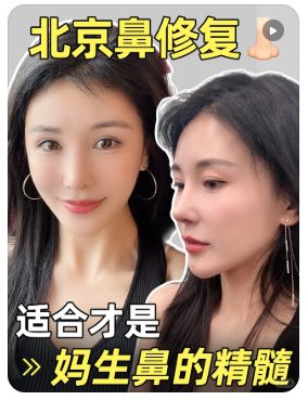 宫风勇 北京宫风勇做鼻修复技术怎么样?宫风勇隆鼻修复收费贵不贵?