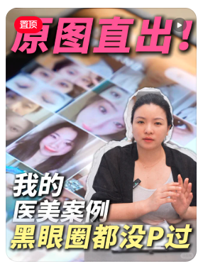 北京郝红梅做双眼皮到底怎么样?看到很多郝红梅双眼皮案例很自然!
