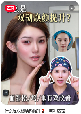 上海崔红蕾双韧提升效果怎么样？崔红蕾面部提升预约咨询电话