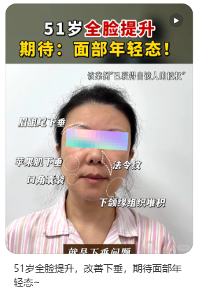 2026北京面部提升专家杜太超和袁强提升拉皮哪个好？