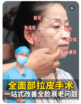 北京面部提升专家谁最好？冯国平面部提升技术怎么样？冯国平拉皮多少钱？