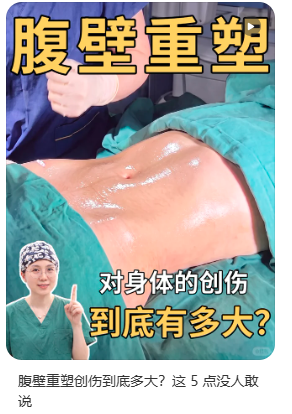 上海九院腹壁整形谁做得好？傅秀军和张铮哪个医生做腹壁年轻化好？