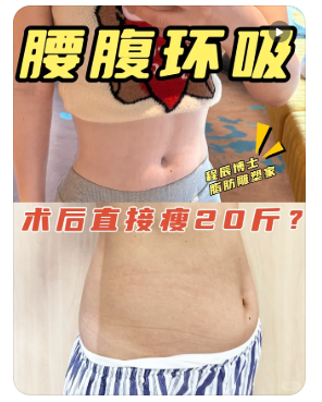 上海九院吸脂专家程辰和谢芸哪个医生技术好？