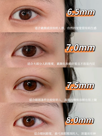 成都华西整形外科双眼皮谁做得好？蒲怡和曹畅哪个医生做双眼皮自然技术好？