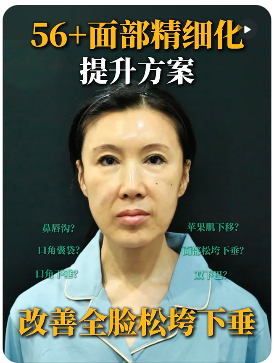 北京做拉皮黄寅守和杜太超对比哪个医生技术好?