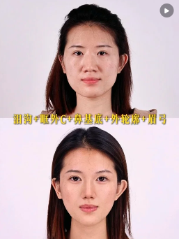 石家庄面部微调马静和王妤哪个医生技术好?