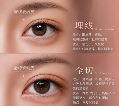 呼和浩特割双眼皮白虎和裴大伟到底选谁？哪个医生更好？